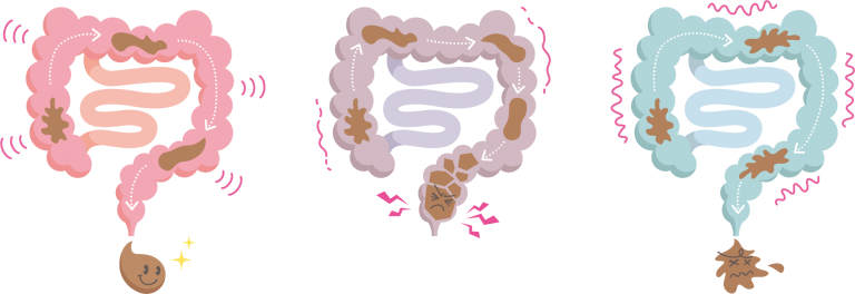 快便と便秘と下痢のイメージ