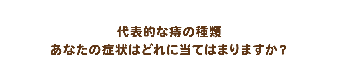 代表的なじの種類